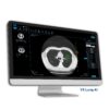V5med Lung AI - Công cụ hỗ trợ chẩn đoán đạt chuẩn lâm sàng