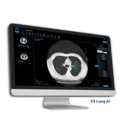 V5med Lung AI - Công cụ hỗ trợ chẩn đoán đạt chuẩn lâm sàng